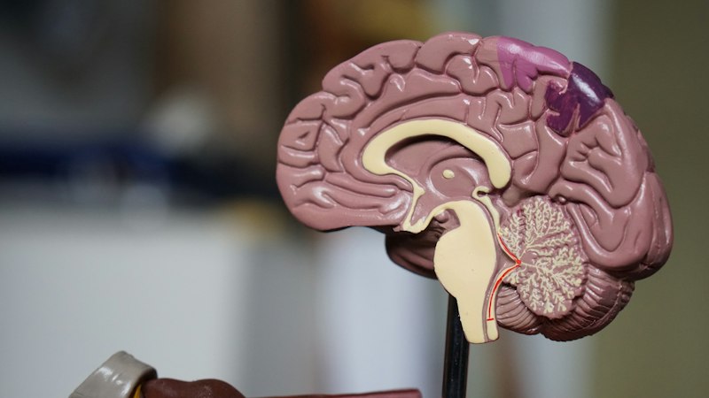 Brain health and focus